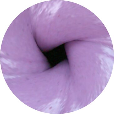 Unique Vortex